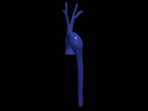 Aorta 3D Modell