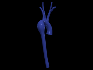 Aorta 3D Modell