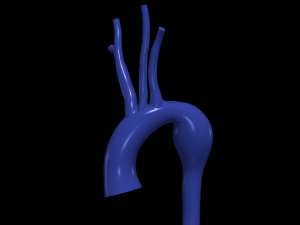 Aorta 3D Modell