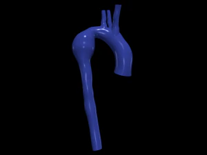 Aorta 3D Model