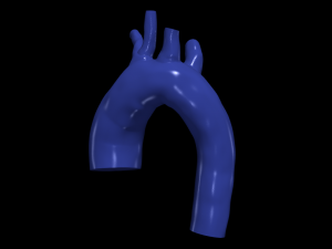 Aorta 3D Model