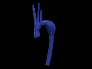 Aorta 3Dモデル