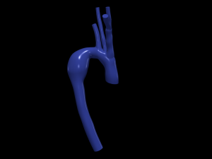 Aorta 3Dモデル