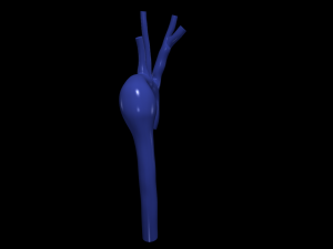 Aorta 3Dモデル