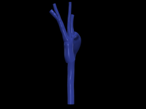 Aorta 3Dモデル