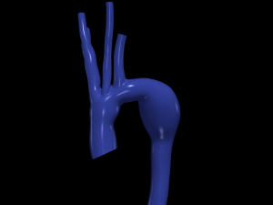 Aorta 3Dモデル