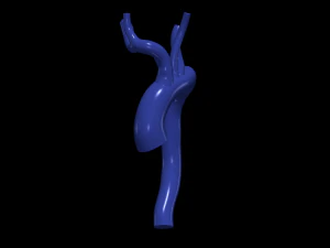 Aorta 3D Model
