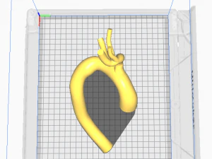 Aorta 3D Model