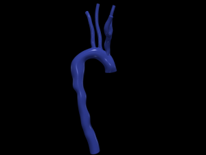Aorta 3D Model