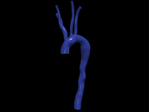 Aorta 3D Model