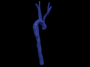Aorta 3D Model