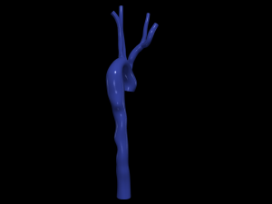 Aorta 3D Model
