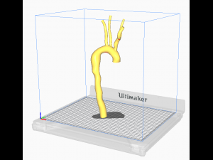 Aorta 3D Model