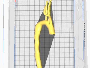 Aorta 3D Model