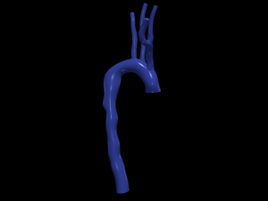 Aorta 3D Model