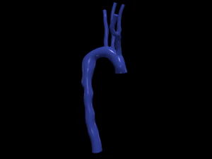 Aorta 3D Model