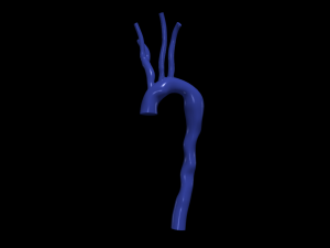 Aorta 3D Model