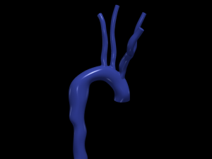 Aorta 3D Model