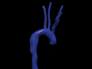 Aorta 3D Model