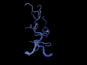 Cerebrovascular system 3Dモデル