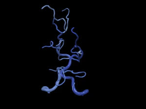 Zerebrovaskul&auml;res System 3D Modell