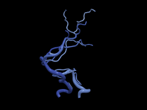 Cerebrovascular system Modelo 3D