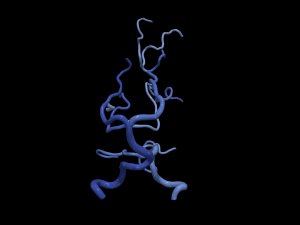 Cerebrovascular system Modelo 3D