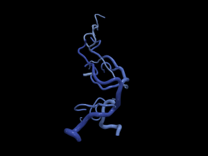 Cerebrovascular system Modelo 3D