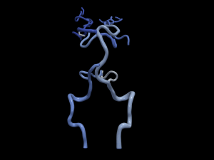 Cerebrovascular system 3D Model