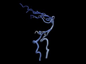 Cerebrovascular system 3D Model