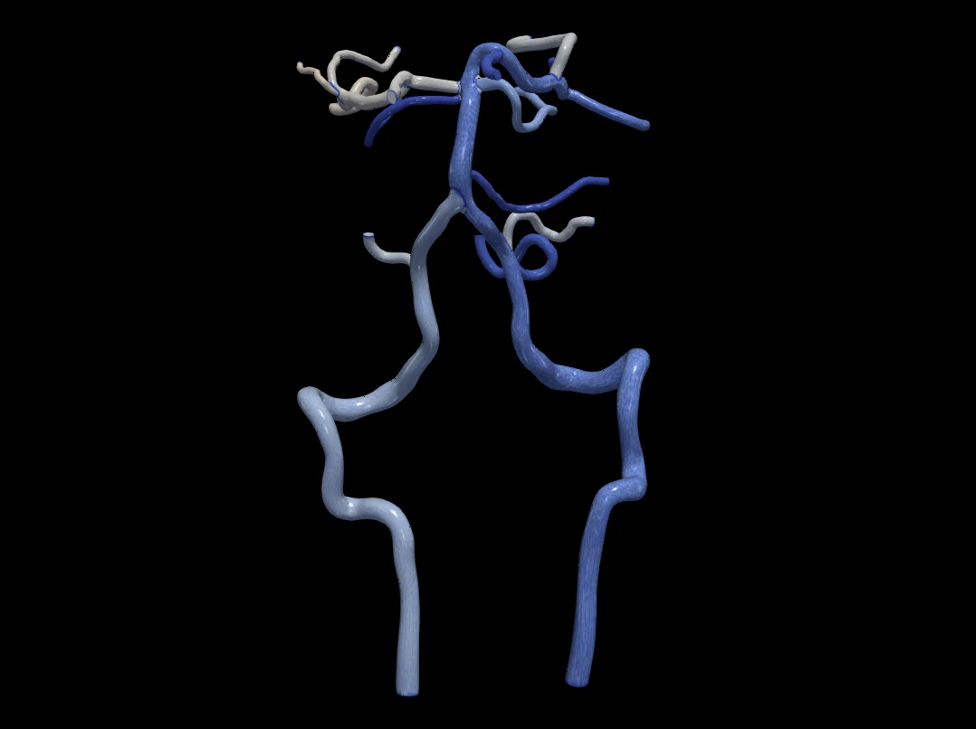 Cerebrovascular system 3D Model .c4d .max .obj .3ds .fbx .stl .blend 
