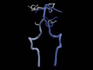 Cerebrovascular system Model 3D