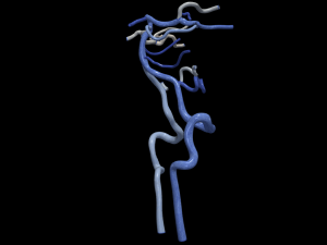 Cerebrovascular system Modello 3D