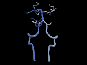 Cerebrovascular system Modello 3D