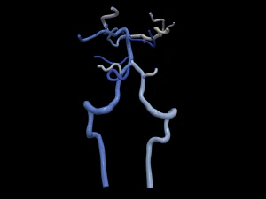 Cerebrovascular system 3D Model