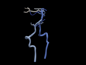 Cerebrovascular system Modello 3D