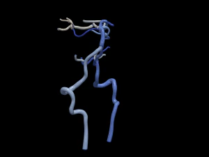 Cerebrovascular system 3D Model