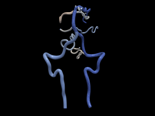 Cerebrovascular system Modelo 3D .c4d .max .obj .3ds .fbx .stl .blend 