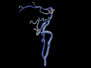 Cerebrovascular system Modelo 3D