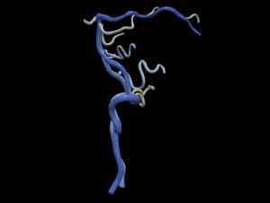 Cerebrovascular system Modelo 3D
