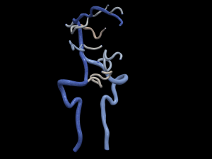 Cerebrovascular system Modelo 3D