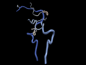 Cerebrovascular system Modelo 3D