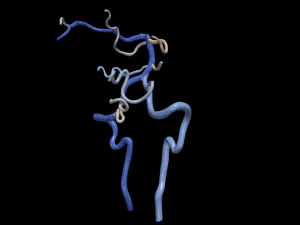Cerebrovascular system 3D Model