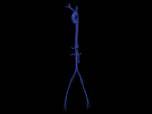 Aortofemoral 3D Model