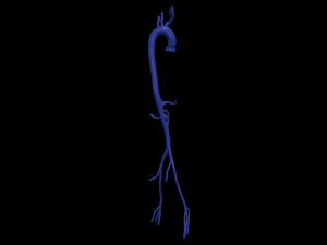 Aortofemoral Model 3D