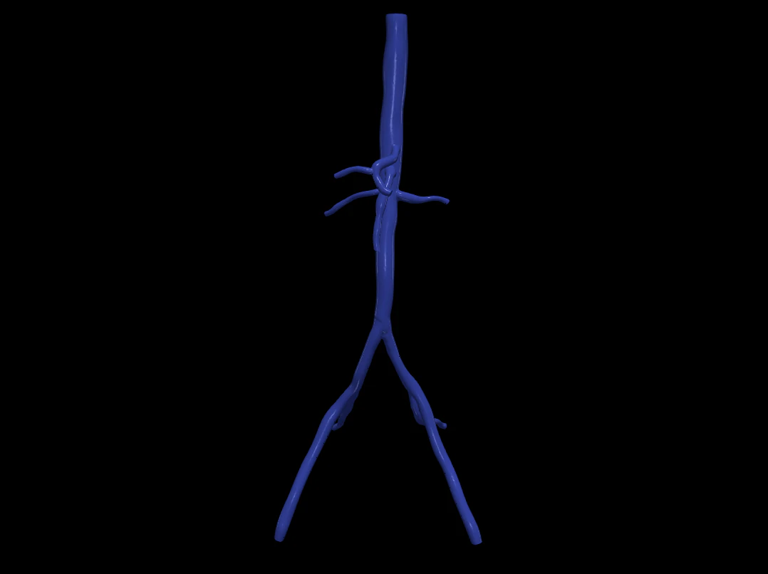Aortofemoral 3D Model .c4d .max .obj .3ds .fbx .stl .blend 