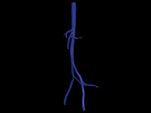 Aortofemoral 3D मॉडल