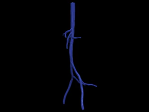 Aortofemoral 3D Model