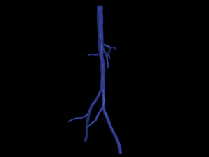 Aortofemoral 3D मॉडल