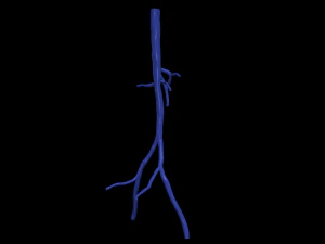 Aortofemoral 3D Model